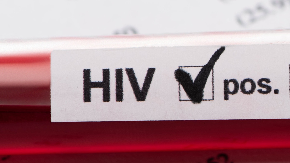 Vokietijoje naujų ŽIV infekcijų skaičiai „vis dar yra per dideli“
