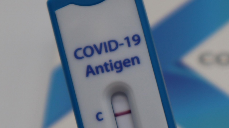 Beveik kas trečias Vokietijos gyventojas reguliariai atlieka COVID-19 testą